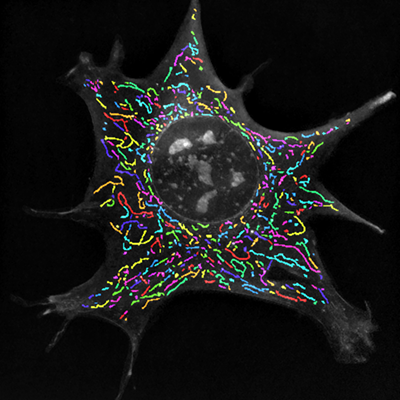 Preadipocyte SMtA Overlays Preadipocyte SMtA Overlays