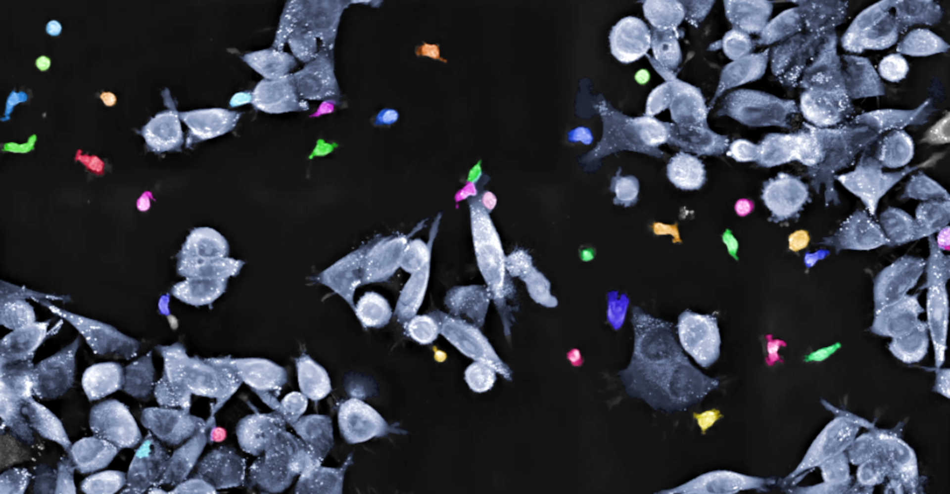 T cells cancer cells T cells cancer cells segmentation