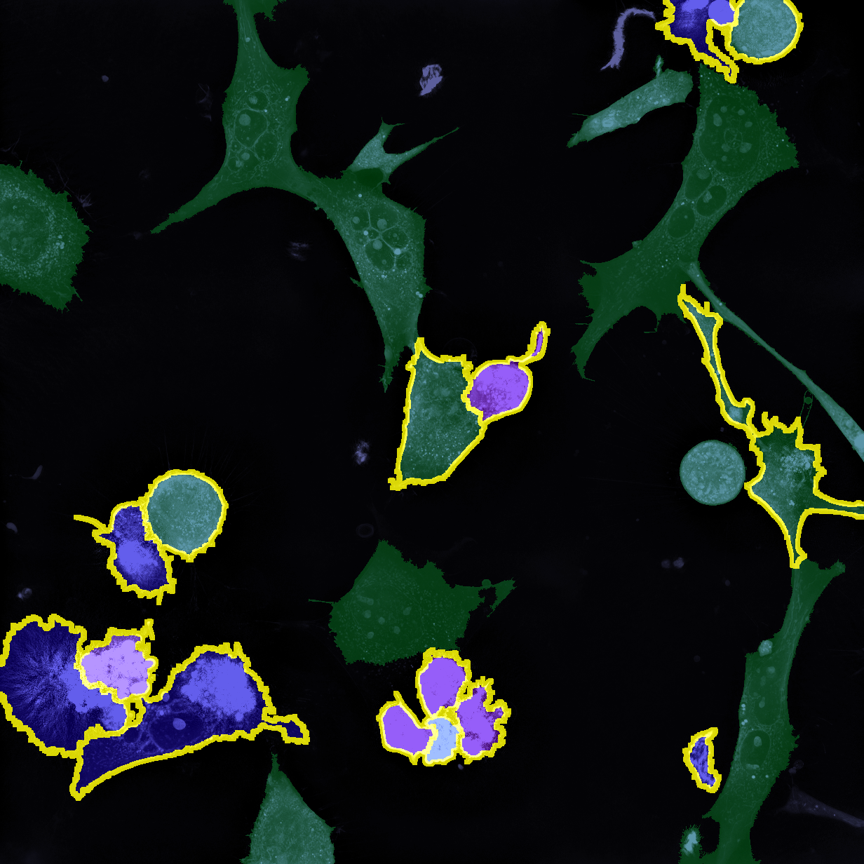 T=15_drug1wellA2_LAN_cancerbiopop LIVE Cytotoxicity Assay