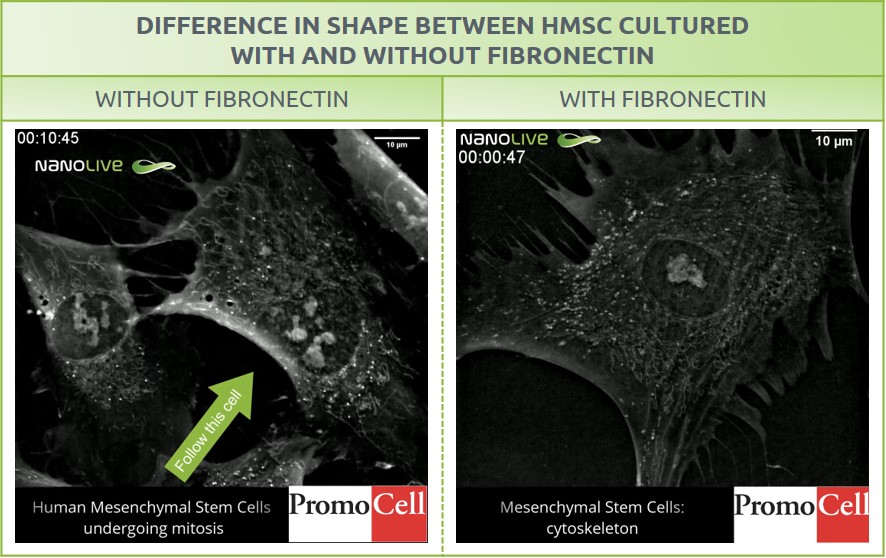 Cytoskeleton - With and without fibronectin Cytoskeleton - With and without fibronectin