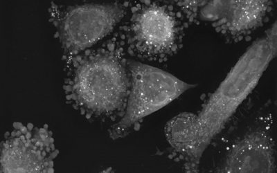 Investigating the cellular adhesion process in non‐small cell lung cancer cells using Nanolive imaging