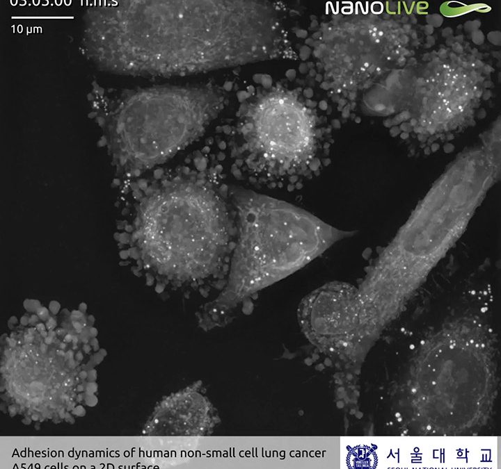 Investigating the cellular adhesion process in non‐small cell lung cancer cells using Nanolive imaging