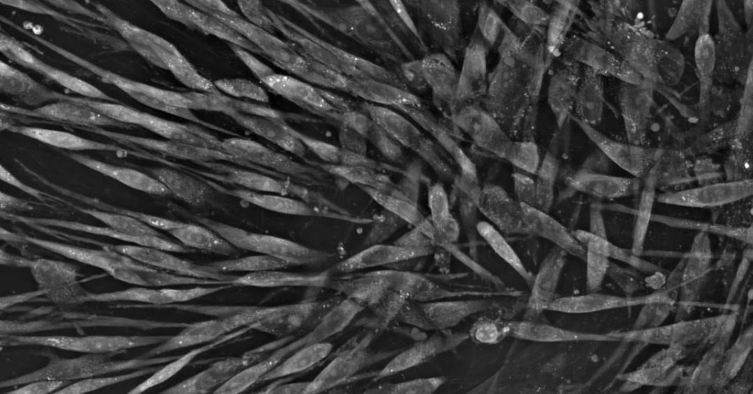 A stem cell differentiation story