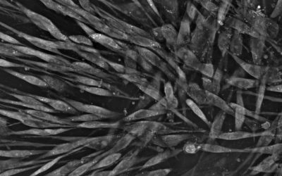 A stem cell differentiation story