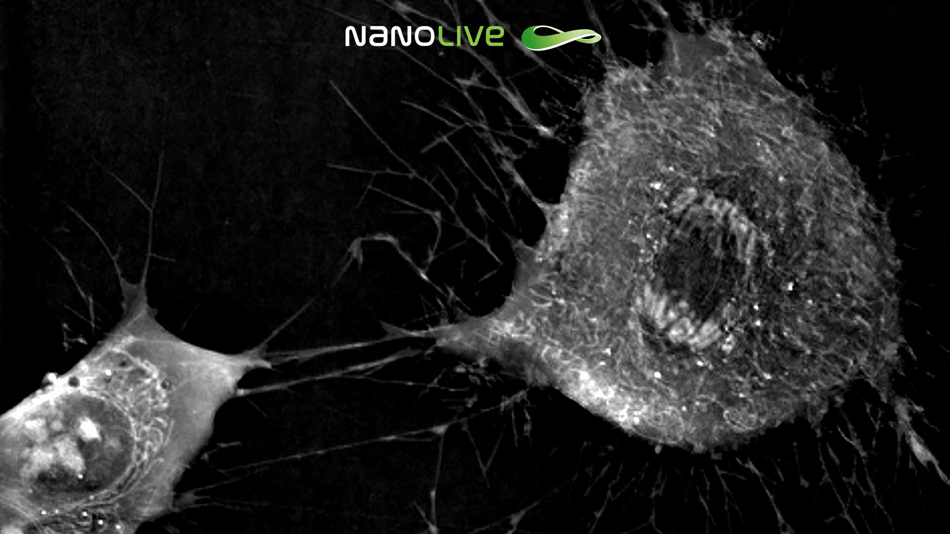 Anaphase in mesenchymal stem cell undergoing mitosis 3D Cell Explorer Anaphase in mesenchymal stem cell undergoing mitosis 3D Cell Explorer