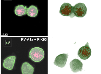 Label free digital holo-tomographic microscopy reveals virus-induced cytopathic effects in live cells