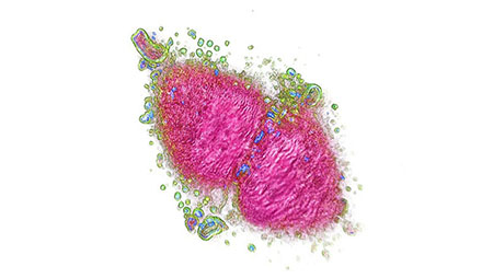 Cancer cell Cancer cell