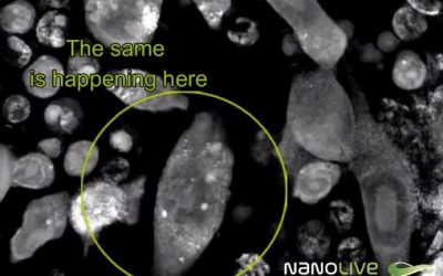 Immuno-Oncology: T-cells targeting and killing cancer cells