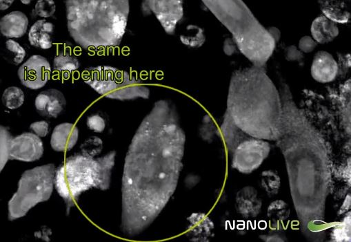 Immuno-Oncology: T-cells targeting and killing cancer cells