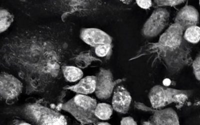 Webinar: Label-free live cell imaging meets Immuno-oncology