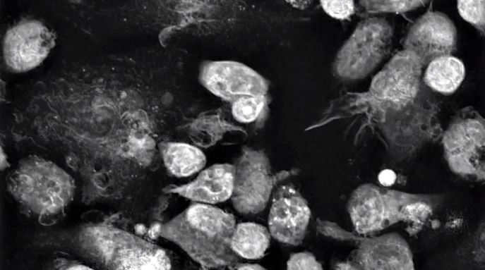 Webinar: Label-free live cell imaging meets Immuno-oncology
