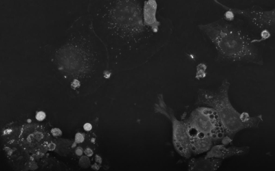 New possibilities for potent cancer immunotherapies with Nanolive solutions