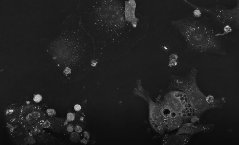 New possibilities for potent cancer immunotherapies with Nanolive solutions