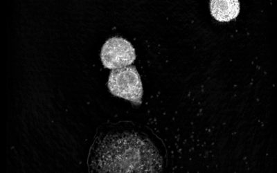 Label-free live cell imaging of antigen mediated mast cell degranulation in collaboration with the Max-Planck-Institute