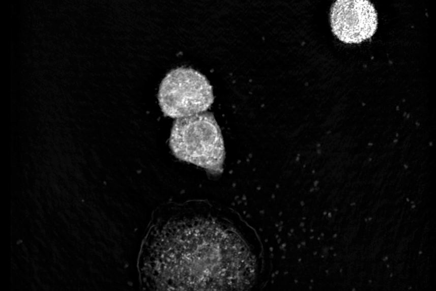 Label-free live cell imaging of antigen mediated mast cell degranulation in collaboration with the Max-Planck-Institute