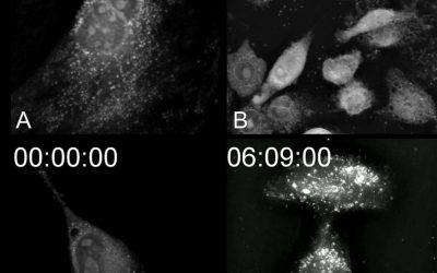 Cell death: 4 ways to die!