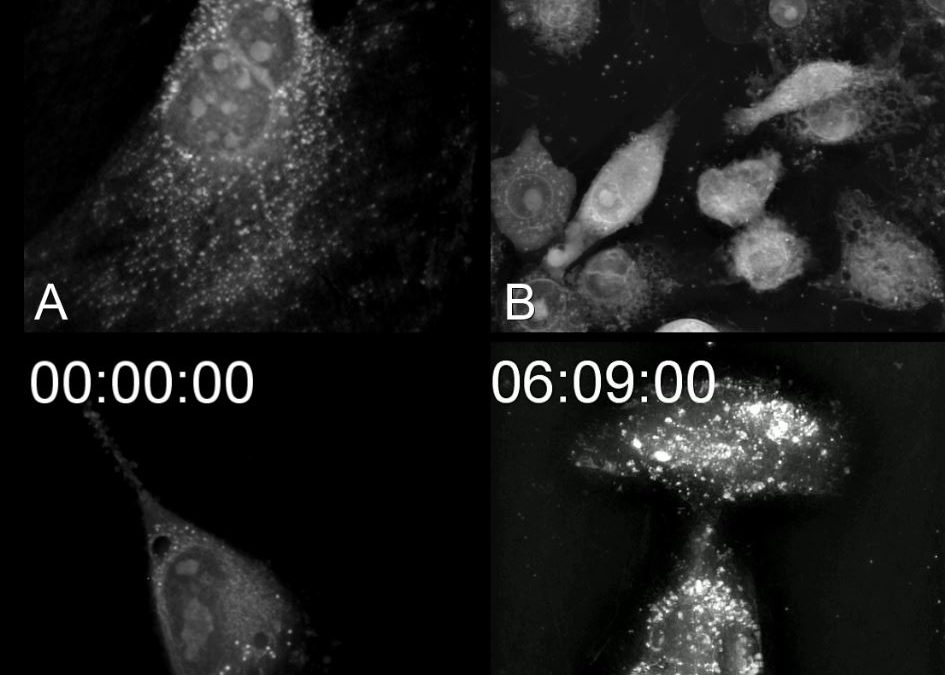 Cell death: 4 ways to die!