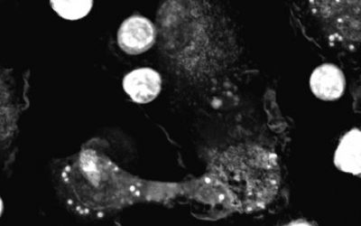 New Application Note: When Holotomography Meets Immuno-Oncology