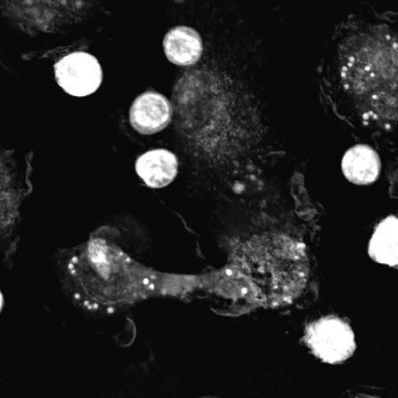 New Application Note: When Holotomography Meets Immuno-Oncology