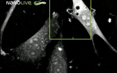 Cell drinking: a closer look on macropinocytosis