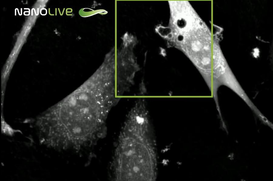 Cell drinking: a closer look on macropinocytosis