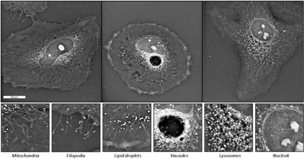 Nanolive imaging seminar in Padua, Italy