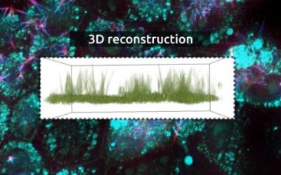 Cilia visualization in Xenopus cells