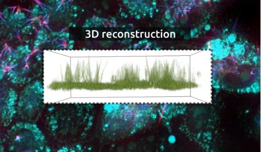 Cilia visualization in Xenopus cells