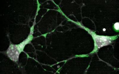 Mitochondrial trafficking in neurons
