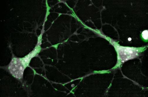 Mitochondrial trafficking in neurons