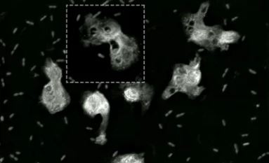 Pneumonia bacteria phagocyted by neutrophils