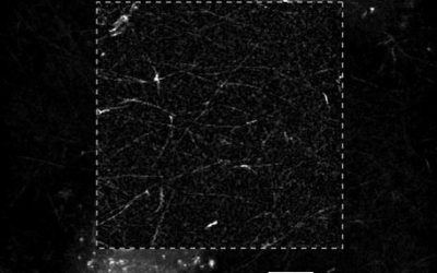 Marker-free visualization of fibrin network formation by MDA-MB-231 cells