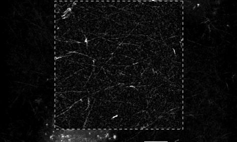 Marker-free visualization of fibrin network formation by MDA-MB-231 cells