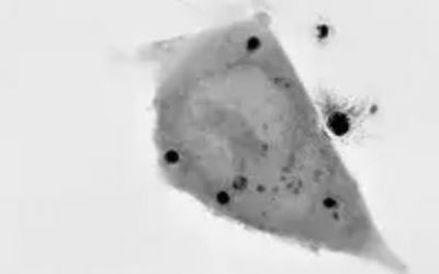 Nanolive technology highlights the importance of wnt signaling in organoid self-organization