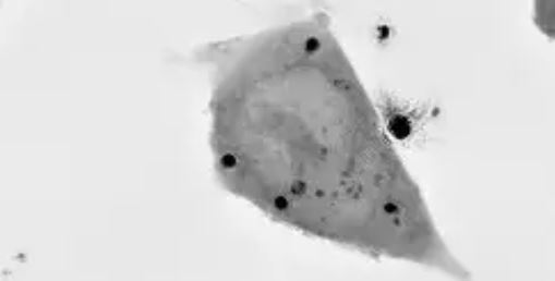 Nanolive technology highlights the importance of wnt signaling in organoid self-organization