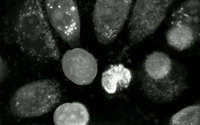 Nanolive technology reveals ferroptosis execution in an aggressive human prostate cancer model