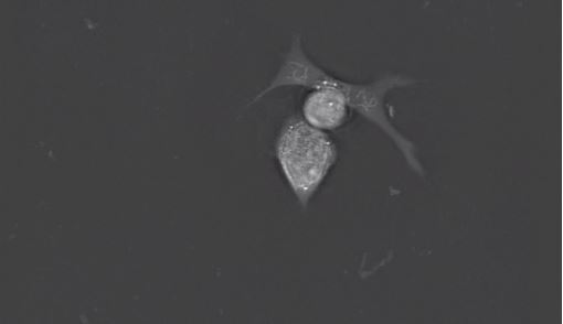 Testimonial: “The Nanolive 3D Cell Explorer is a powerful tool to measure morphologic and functional features of live stem cells”