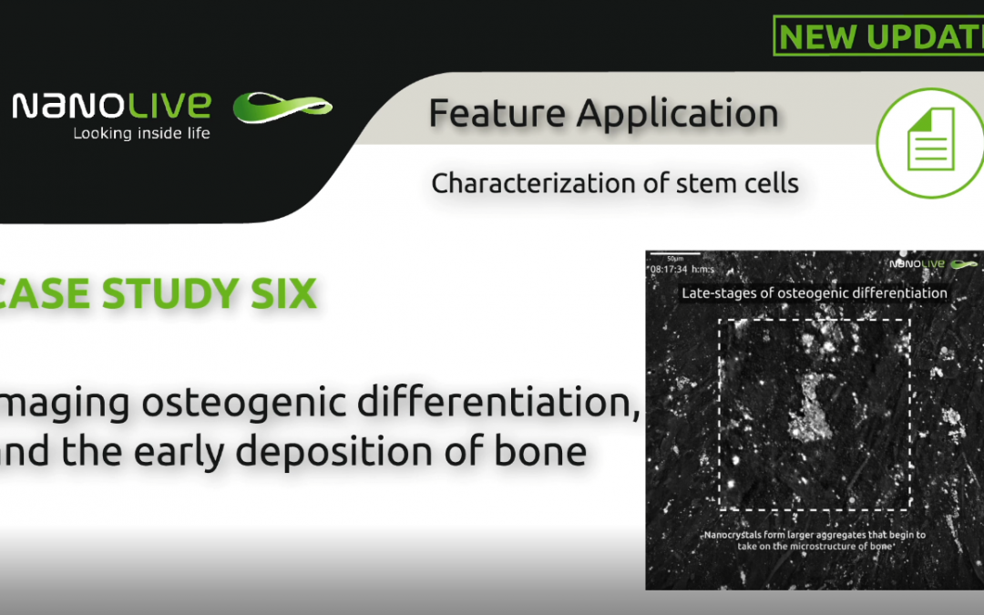 Imaging osteogenic differentiation, and the early deposition of bone