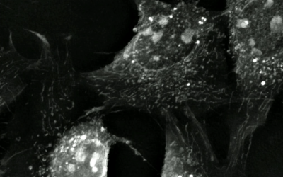 Is it possible to capture horizontal mitochondrial transfer in real time using Nanolive cell imaging?