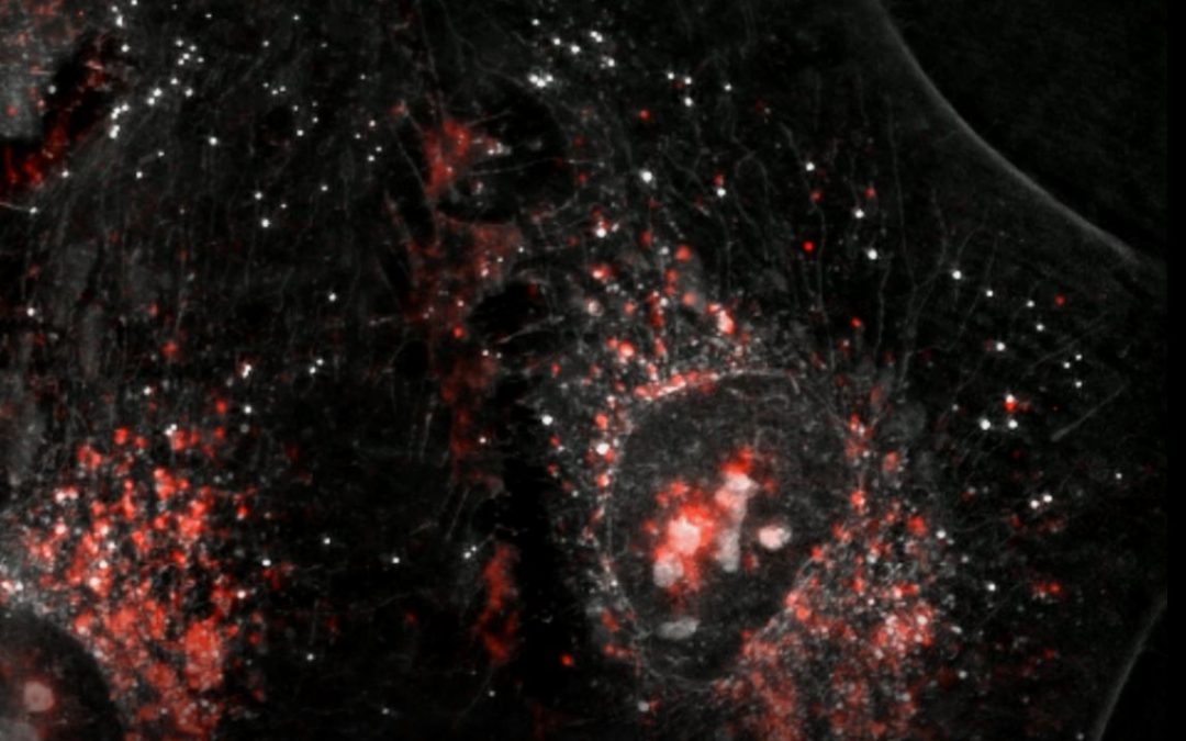 Papillomavirus infection in HeLa cells