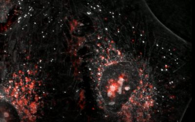 Papillomavirus infection in HeLa cells