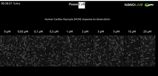 Concentration-dependent cytotoxic effect of doxorubicin on human cardiac myocytes
