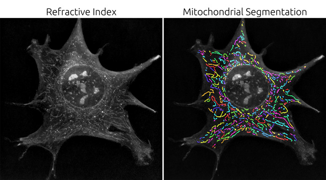Figure-1 Figure 1. Nanolive’s holotomographic imaging and mitochondrial detection.
