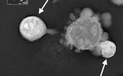 Neutrophils are mediators of metastatic prostate cancer progression in bone