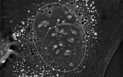 Lamellar Bodies and Keratohyalin Granules in Normal Human Epidermal Keratinocytes