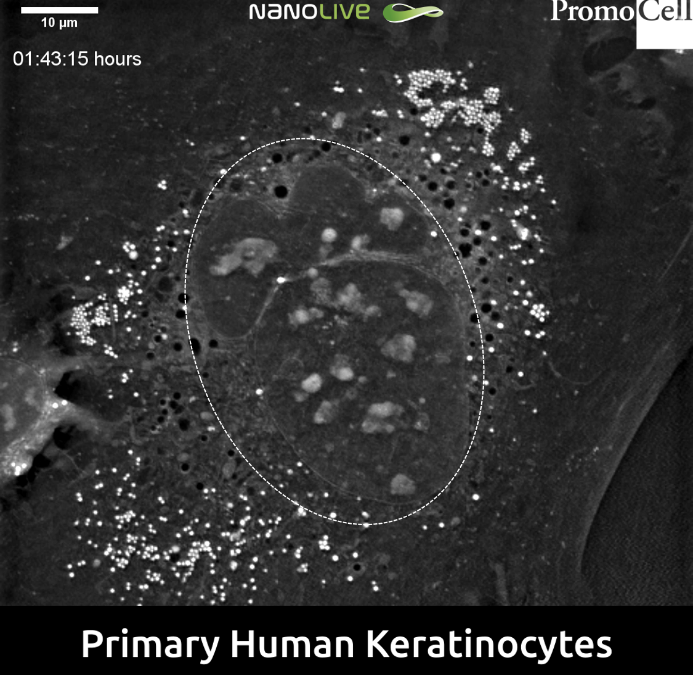 Lamellar Bodies and Keratohyalin Granules in Normal Human Epidermal Keratinocytes