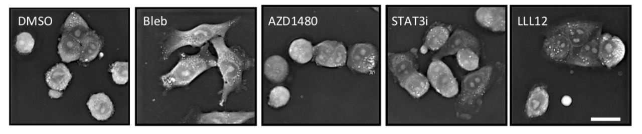 Morphological analysis of melanoma cells. Huang K-Y. et al. (2024)