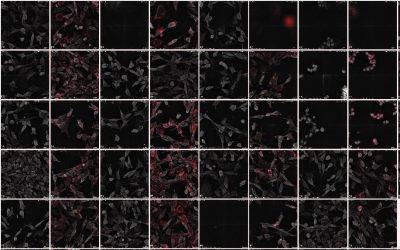New publication: Autophagosome accumulation-mediated ATP energy deprivation induced by penfluridol triggers nonapoptotic cell death of lung cancer via activating unfolded protein response