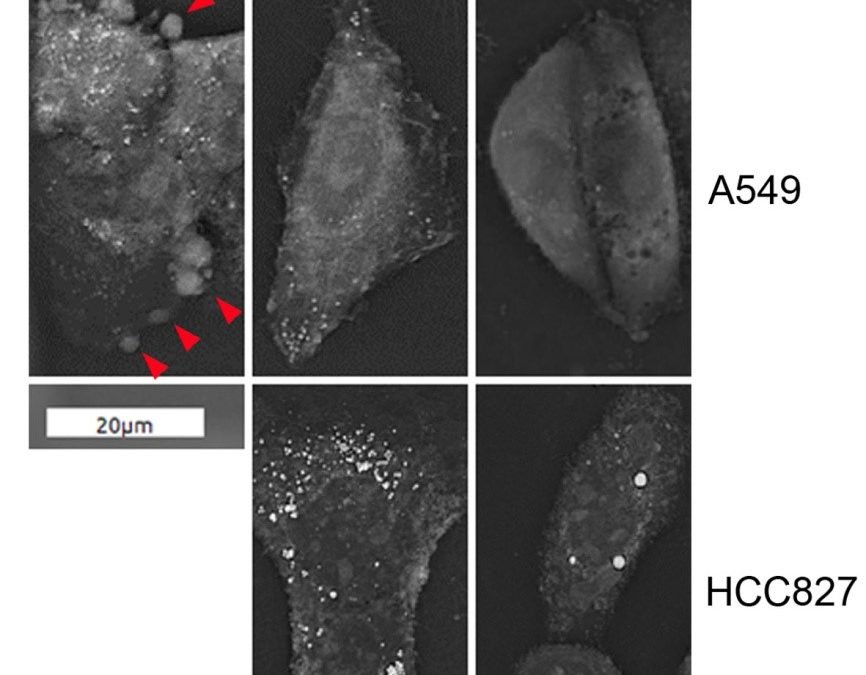 New publication: Autophagosome accumulation-mediated ATP energy deprivation induced by penfluridol triggers nonapoptotic cell death of lung cancer via activating unfolded protein response