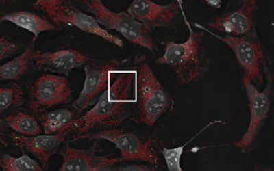 Closer to understanding coronavirus: Research results with Institut Pasteur
